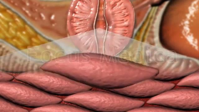 Alpha adrenergic receptor antagonists for BPH - Animated Atlas of BPH and OAB смотреть онлайн