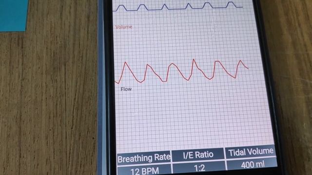EtechRobot Ventilator V2.0 смотреть онлайн