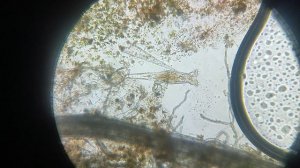 Коловратка кушает