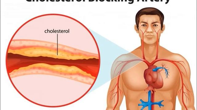 What Are Plant Steroids смотреть онлайн