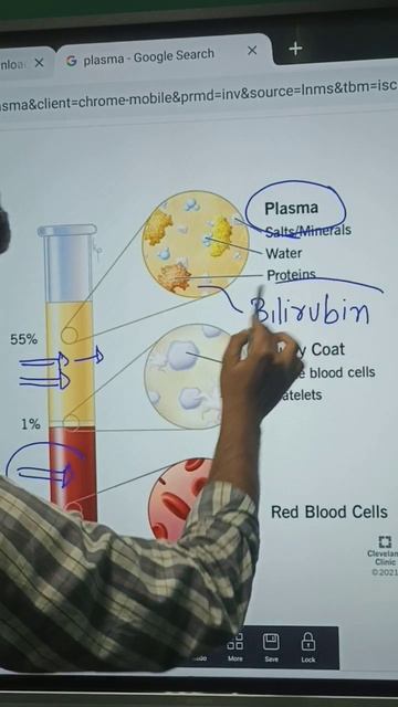 bilirubin yellow colour provider pigment for our body смотреть онлайн