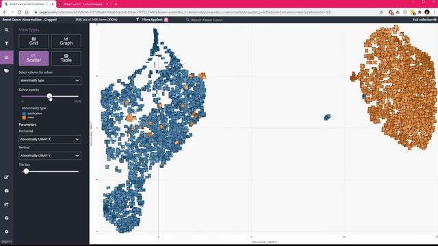DICOM Mammogram Analysis with Zegami смотреть онлайн