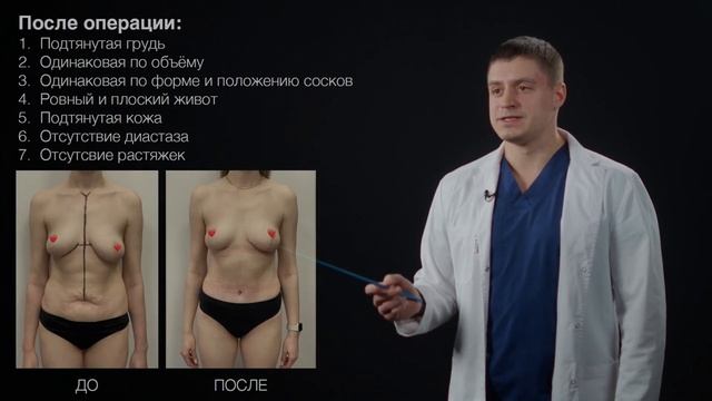 Как восстановить фигуру после родов? смотреть онлайн