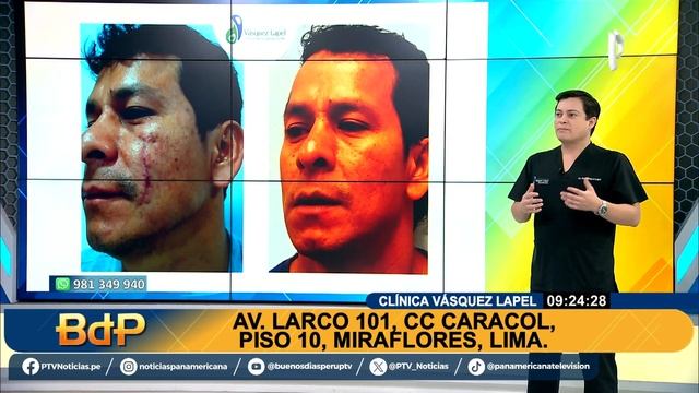 ¿Qué tipo de cicatrices existen y cómo tratarlas con láser? смотреть онлайн