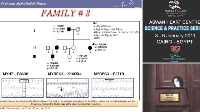 Clinical features and outcome of hypertrophic cardiomyopathy.... смотреть онлайн