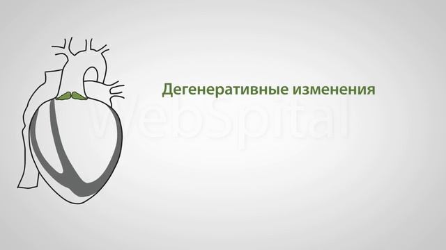 Стеноз аортального клапана смотреть онлайн