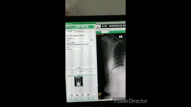 👉👉👉👉👉SGN X Ray Center Barnia Bajar 👈👈👈 смотреть онлайн