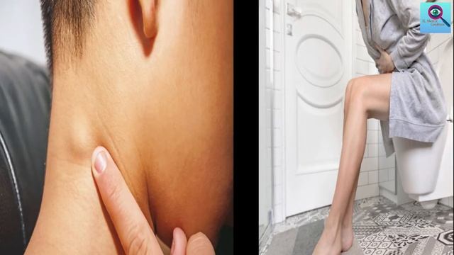 ලිංගික හර්පීස් වලින් ආරක්ෂා වියයුත්තේ ඇයි ? | Genital herpes смотреть онлайн
