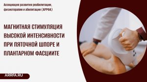 Магнитная стимуляция высокой интенсивности при пяточной шпоре и плантарном фасциите