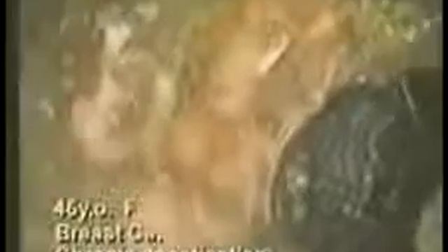 ШОКирующее видео кишечник смотреть онлайн