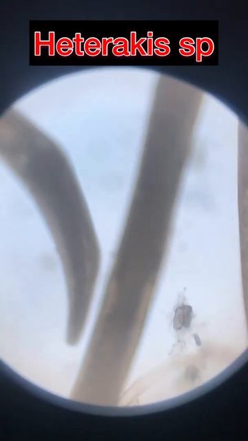 Nematode parasite (slide 03) смотреть онлайн