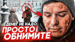 РЕАКЦИЯ прохожих на БОЛЬНОГО / Обними меня, у меня ВИЧ соц эксперимент