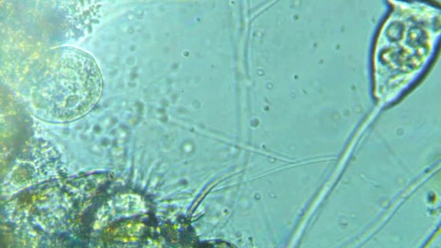 Vorticella смотреть онлайн