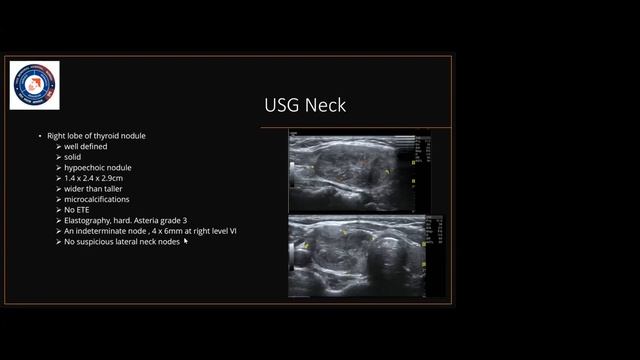 Mahamana case discussion series Thyroid carcinoma Date 24 March 2022 смотреть онлайн
