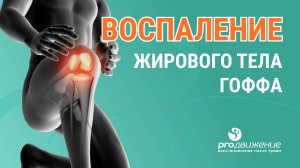 👨⚕️ 🦵 Воспаление жирового тела Гоффа