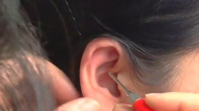 Auricular Electrical Diagnosis -- Constipation -- Online Acupuncture CEU смотреть онлайн