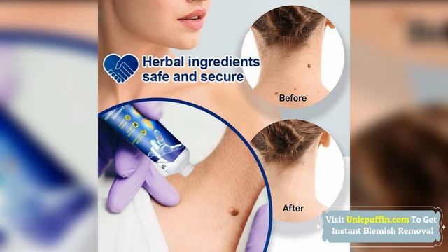 Instant Blemish Removal Gel - Sumifun Wart Remover