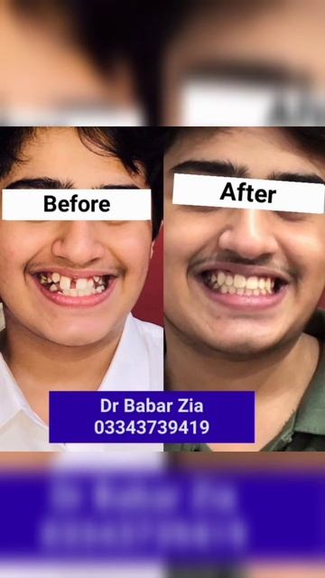 Orthodontic treatment смотреть онлайн