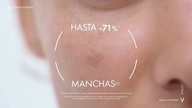 Liftactiv B3 reductor de manchas смотреть онлайн