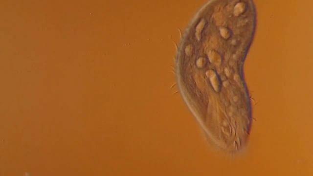 Urostyloid 200x/DIC смотреть онлайн