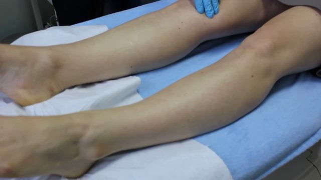 Diodowy laser Palomar Vectus. Zabieg depilacji laserowej w Glamour Vectus.