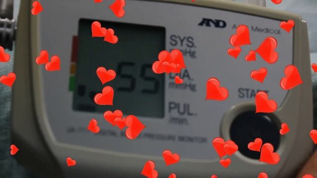 По состоянию на 30 июля 2020 года моё артериальное давление 114/70-56!!! смотреть онлайн