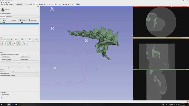 Tutorial: Ct scan to 3D print in 15 minutes using free software only. смотреть онлайн