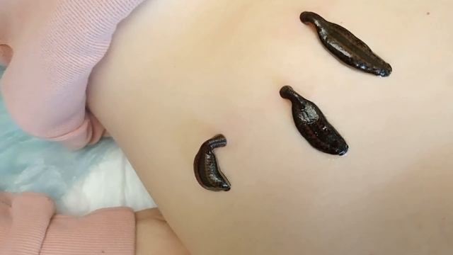 !!!!ПИЯВКИ!!!!!ПОЛЬЗА!!!!!!🪱🪱🪱