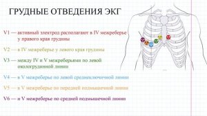 24 ЭКГ и тоны