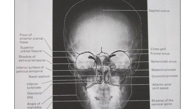 Extraoral Radiography & Indication | Oral Medicine and Radiology | BDS | 00841 | PPT Only смотреть онлайн