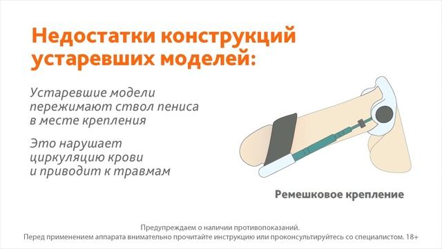 Видеообзор Экстендера PeniMaster Pro смотреть онлайн