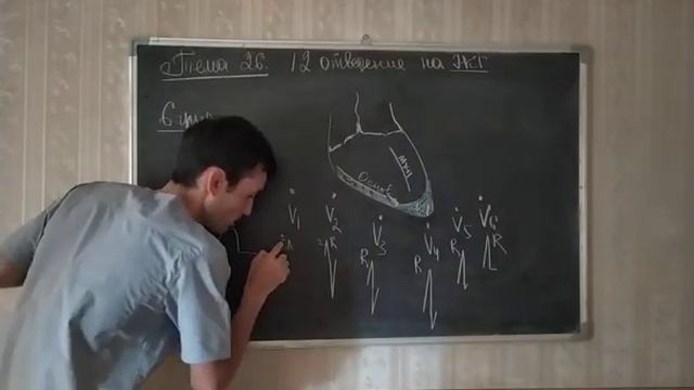26 ЭКГ 12 ОТВЕДЕНИЙ