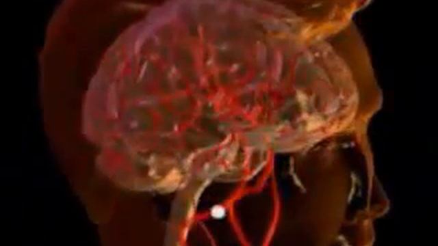 How To Lower Your Blood Cholesterol The Natural Way - Edmark Red Yeast Coffee смотреть онлайн