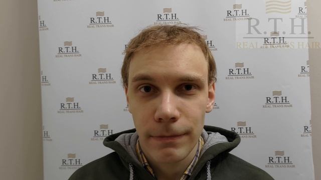 После пересадки волос☀️ смотреть онлайн