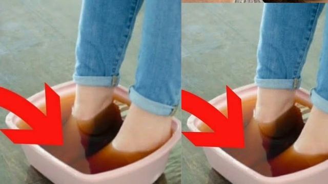 OYOQ TERLASHINI YO‘QOTISH, TABLETKA ORQALI | ОЙОК ТЕРЛАШИНИ ЙУКОТИШ, ТАБЛЕТКА ОРКАЛИ смотреть онлайн