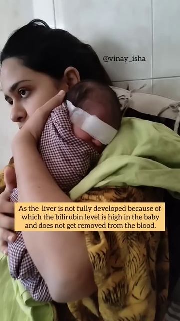 Phototherapy treatment for newborns to cure Jaundice #shorts #newborncare смотреть онлайн