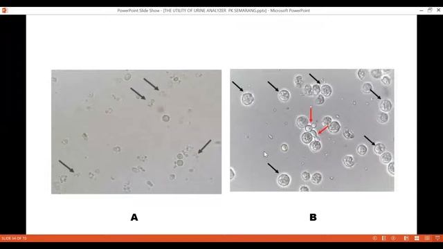 Kuliah Tamu Dr. dr. Hani Susianti, Sp.PK(K) смотреть онлайн