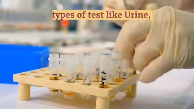 How long Does Nicotine Stay in the Body or System смотреть онлайн