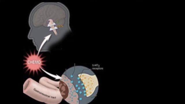 The Role of Serotonin in Chemotherapy Induced Nausea смотреть онлайн