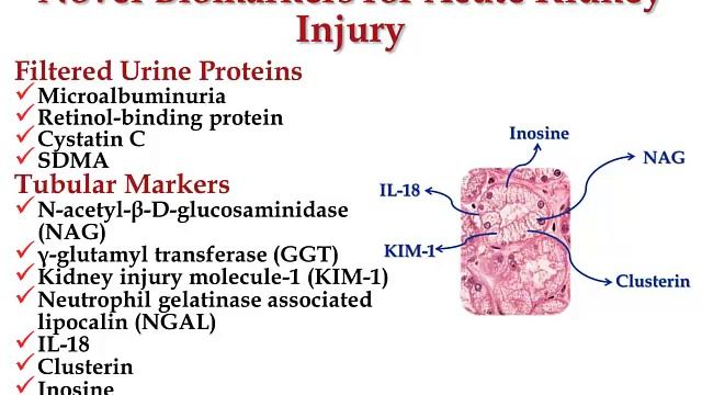 What Biomarkers Are Useful for Acute Kidney Injury (AMC Renal Week 2014) смотреть онлайн