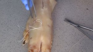 Практический навык  внутрикожный косметический шов Холстеда