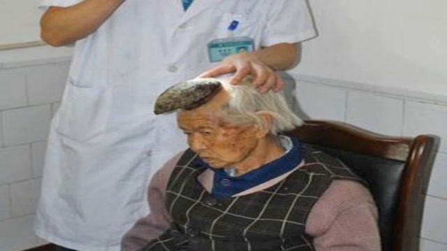 Chinese unicorn woman set to have her horn removed смотреть онлайн