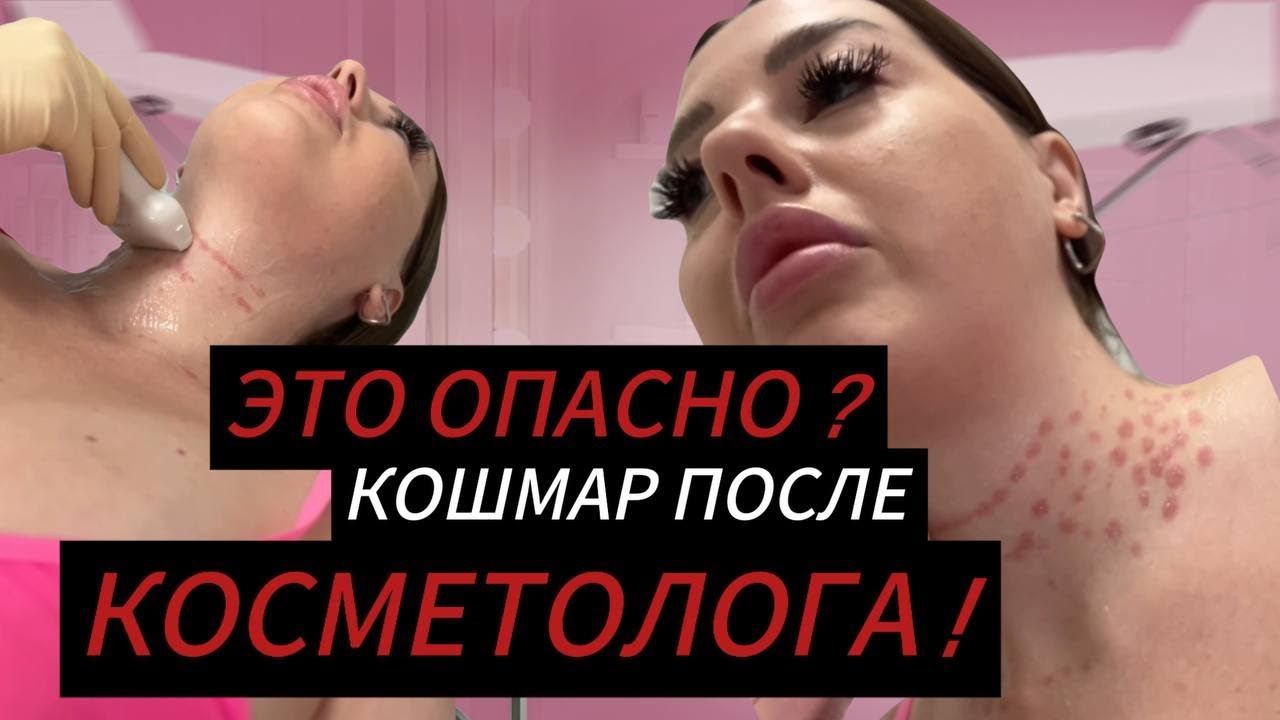 Шок! После посещения косметолога — пятна на шее! УЗИ показало нечто непредсказуемое!