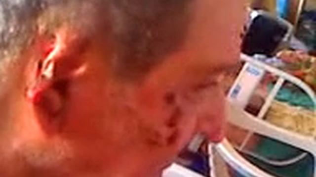 Cura de miasis en carcinoma de celulas basales 2.3gp смотреть онлайн