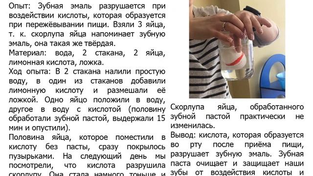 здоровые зубки