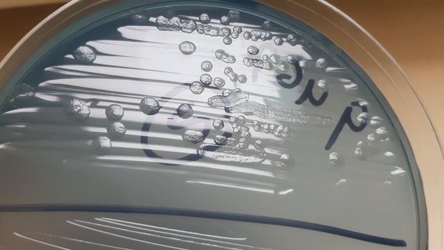 Morgenella morganii Morphology on CLED agar Demonstration смотреть онлайн