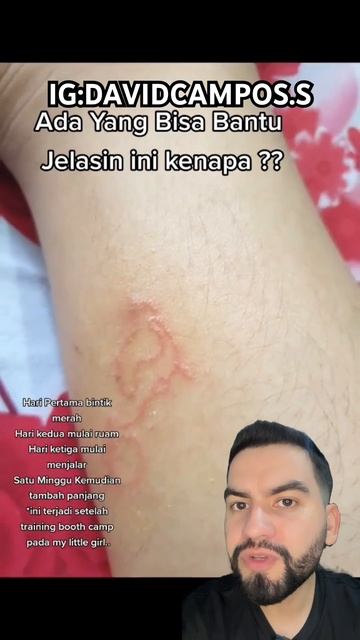 LARVA MIGRANS смотреть онлайн