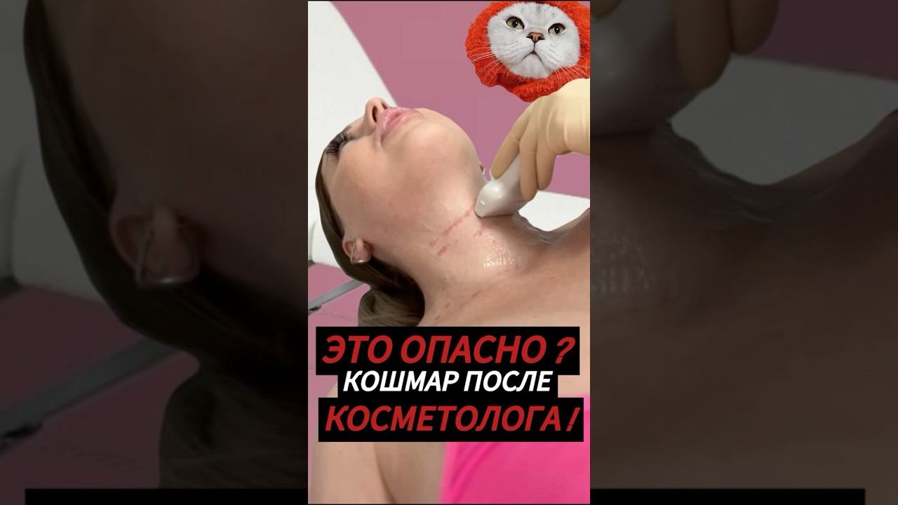 ШОКИРУЮЩИЙ КОШМАР: ЧТО ПРОИСХОДИТ ПОСЛЕ ВИЗИТА К КОСМЕТОЛОГУ ? смотреть онлайн