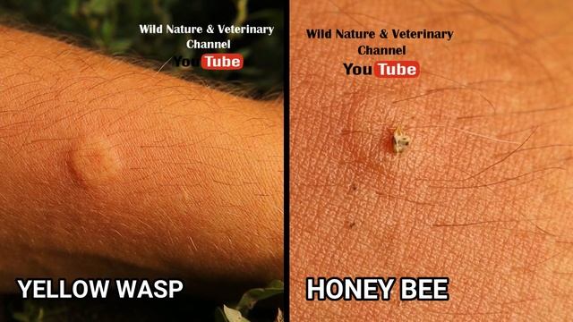 Wasp sting V.s. Hone Bee sting | Can Bees & Yellow Jacket pull out their stingers? Hornet wildlife смотреть онлайн