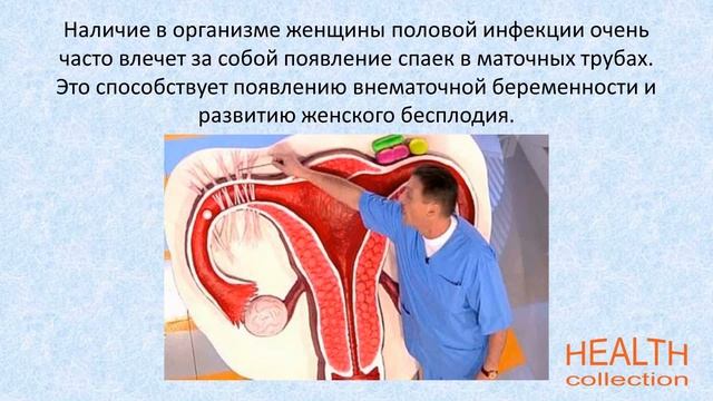 Бесплодие и инфекции смотреть онлайн